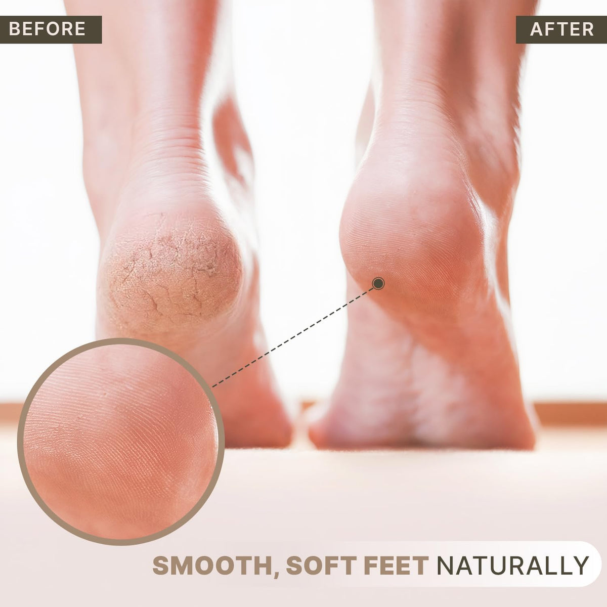 Foot Scrubber for Dead Skin Pumice Stone for Foot Scrub Pedicure Tools ,Feet Scrubber for Smooth Skin (2)10 x 8 x 3cm